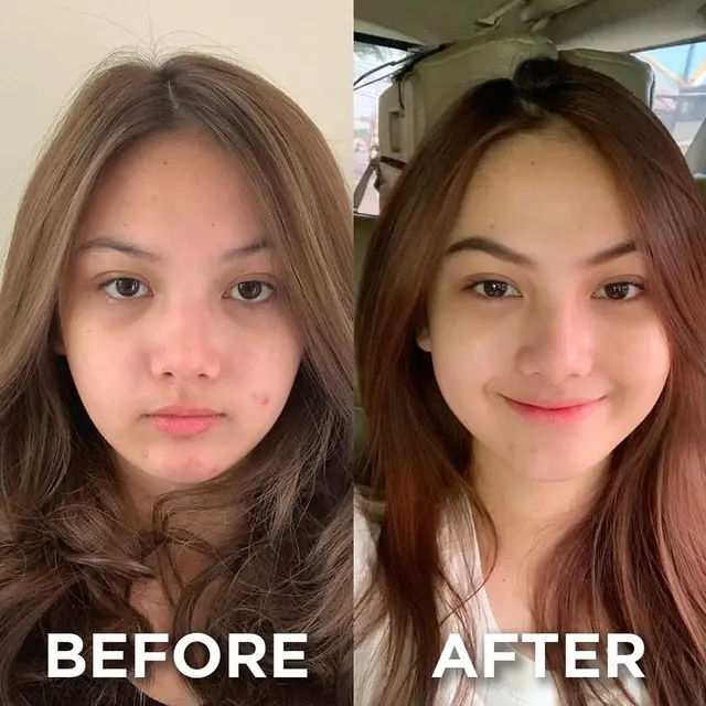 Unggah Foto Berjerawat, Ini 6 Potret Aisyah Aqilah Tanpa Makeup