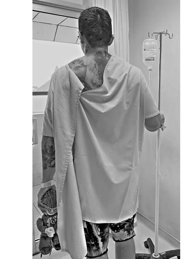 Miller Khan jalani operasi lipoma (Foto: Instagram/@miller_khan)