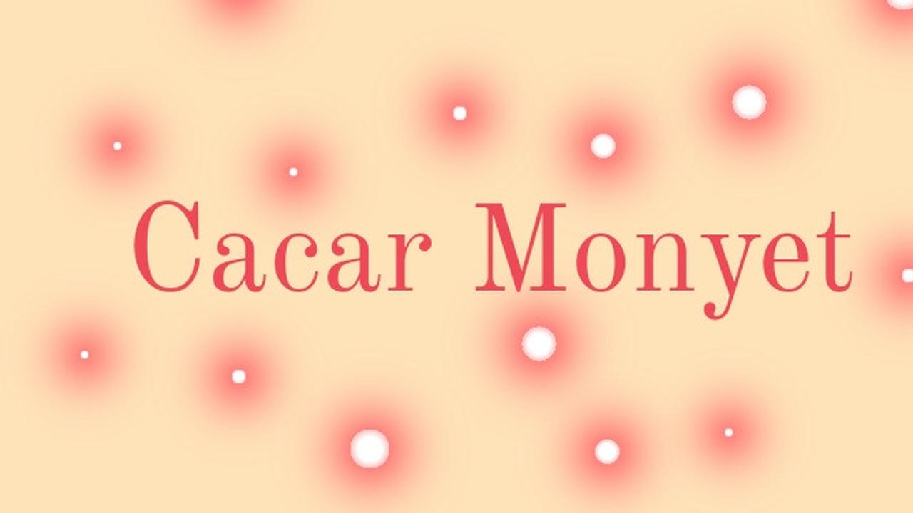 Ilustrasi cacar monyet