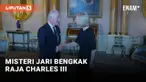 Jari Tangan Raja Charles III Bengkak, Sakit?