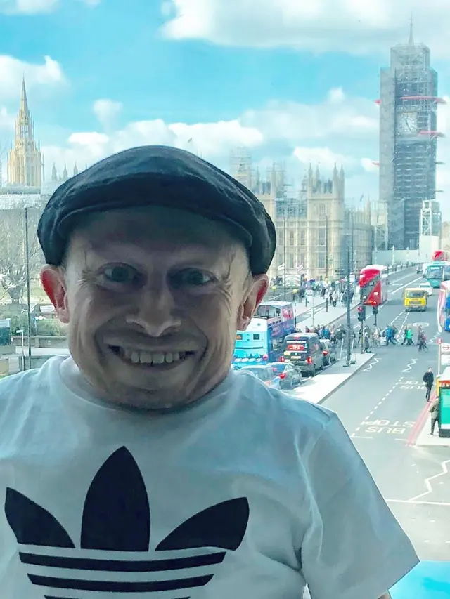 [Bintang] Pemeran Mini-Me di Austin Powers, Verne Troyer Meninggal Dunia