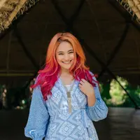 Diidap Marshanda, kenali penyebab dan gejala kanker payudara sejak dini untuk mendapatkan penanganan secara tepat. (Instagram/marshanda99).