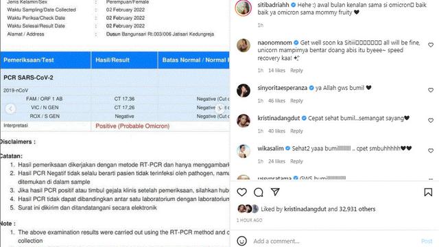 Siti Badriah positif Covid-19 varian Omicron