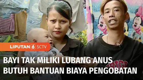 VIDEO: Butuh Bantuan, Bayi 4 Tahun Asal Sukabumi Ini Lahir Tanpa Lubang Anus