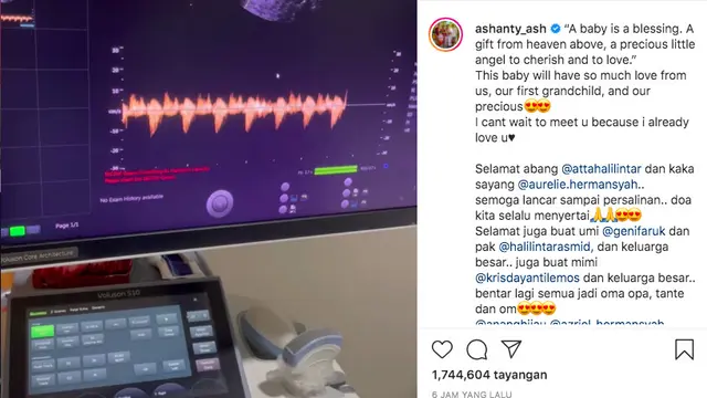 Ashanty Turut Bahagia Aurel Hermansyah Hamil Lagi Setelah Sempat Keguguran
