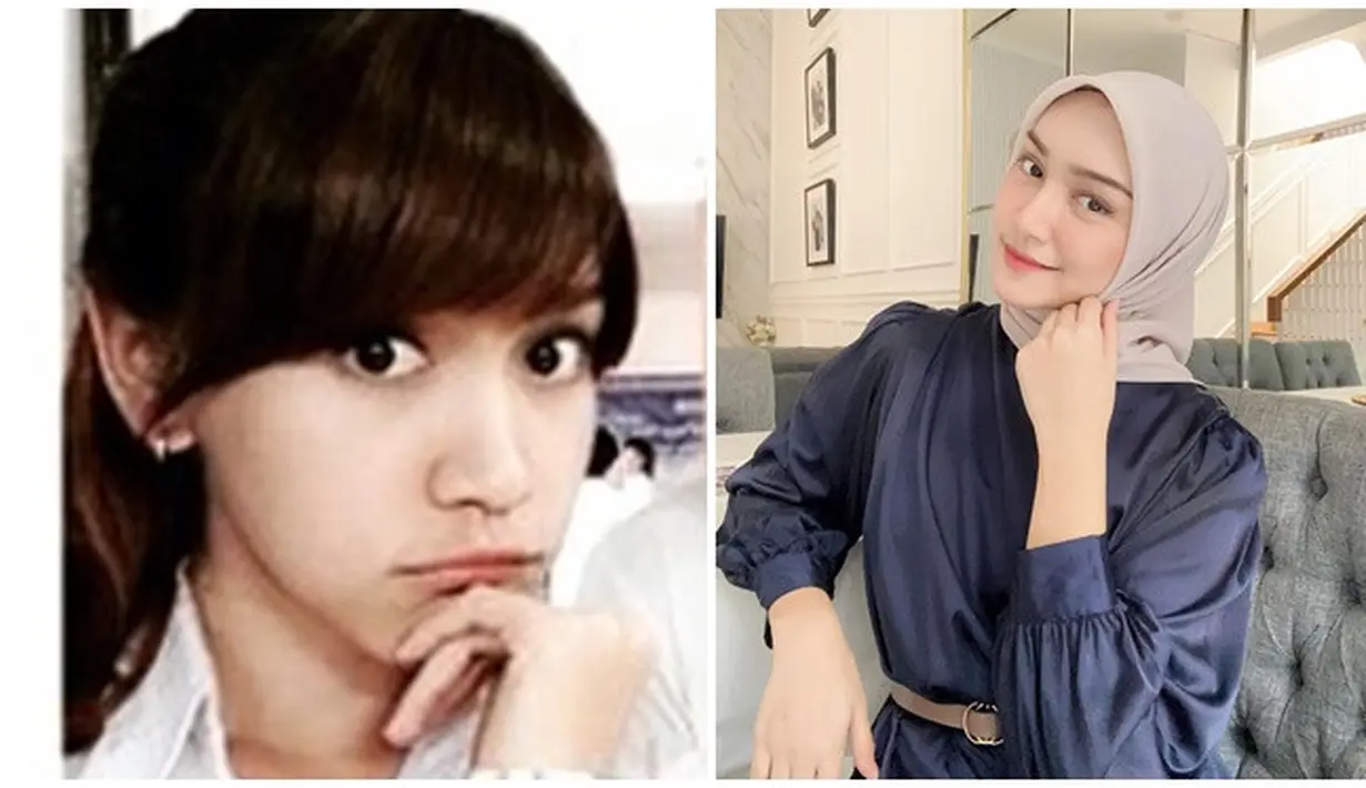 Bintangi sinetron ABG Jadi Manten saat masih berusia 19 tahun, kini usia Melody menginjak 27 tahun. Meski sudah dikaruniai anak, namun tak dipungkiri jika dulu vs kini setelah 9 tahun berlalu, pesona Melody Prima tak luntur. Putuskan berhijab tahun 2017, pemeran Siti Aldona dalam sinetron ABG Jadi Manten ini makin pancarkan pesonanya. Kehidupan Melody Prima belum lama ini jadi sorotan lantaran diam-diam telah bercerai dengan suaminya setelah 6 tahun membangun biduk rumah tangga. (Liputan6.com/IG/@devihandayani1012/@melodyprima)