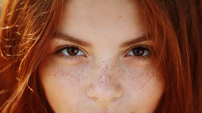 [Bintang] Orang-orang Ingin Mulus, Cewek Ini Malah Bikin Freckles di Wajah