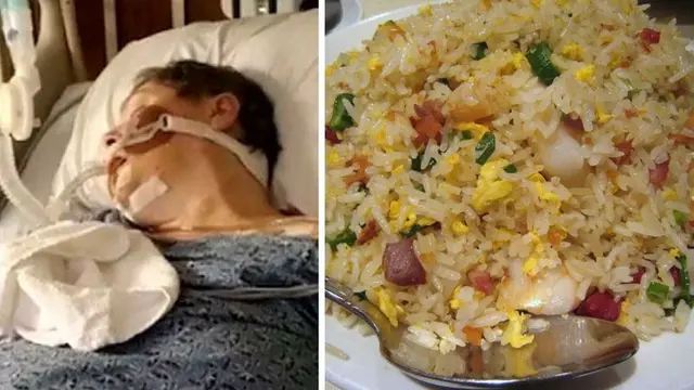 Kena Sindrom Nasi Goreng, Wanita Ini Harus Mendekam di Rumah Sakit