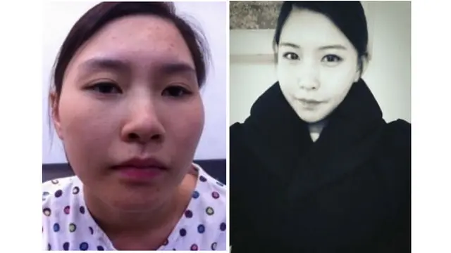 (c) kpsurgery tumblr.com