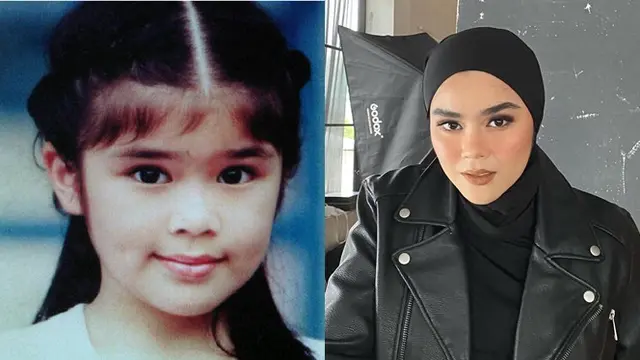 Foto Masa Kecil 5 Personel Eks BLINK, Febby Rastanty Imut Banget