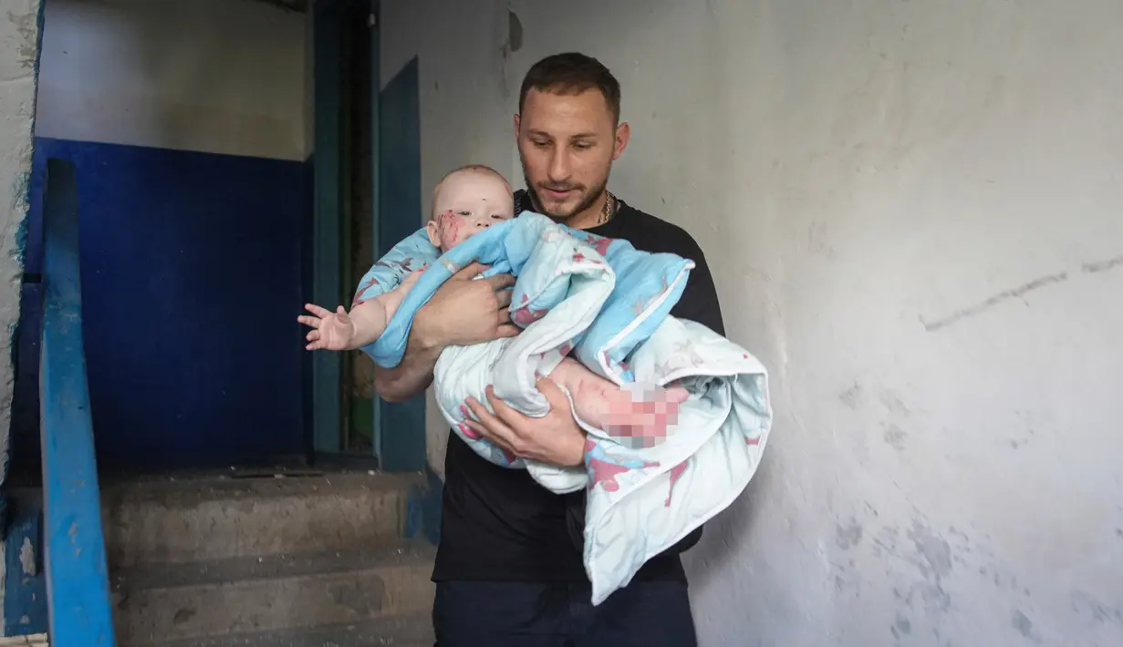<p>Dua belas anak, termasuk dua bayi, termasuk di antara korban luka-luka ketika penduduk Pervomaiskyi di timur laut mengungkapkan keterkejutan mereka atas kejadian tersebut. (AP Photo/Oleksandr Magula)</p>
