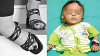 Gara-Gara High Heels Ibunya, Bayi 6 Bulan Ini Meregang Nyawa