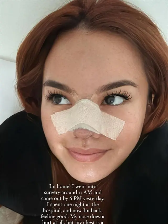 7 Potret Shafa Harris yang Jalani Operasi Plastik pada Hidung di Korea Selatan