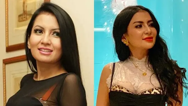 6 Selebriti Tanah Air yang Pernah Suntik Filler Bibir, Terbaru Lucinta Luna
