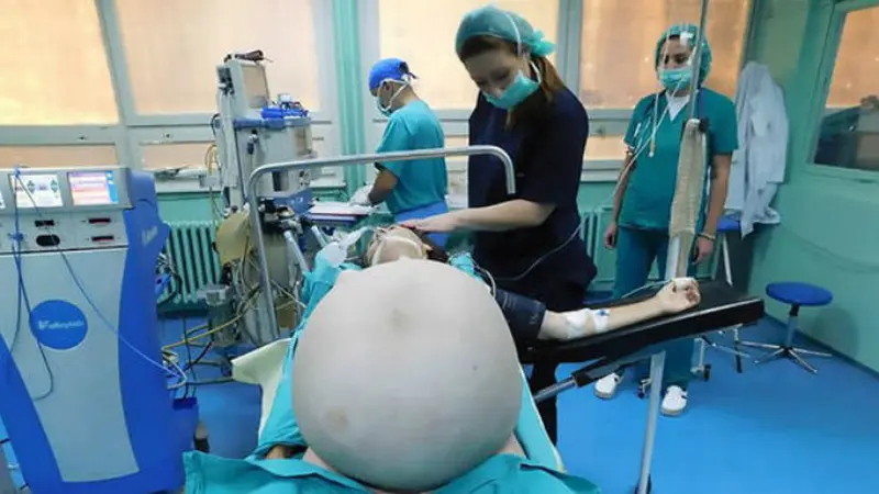 Seorang wanita penderita tumor berbobot 30,8 kilogram