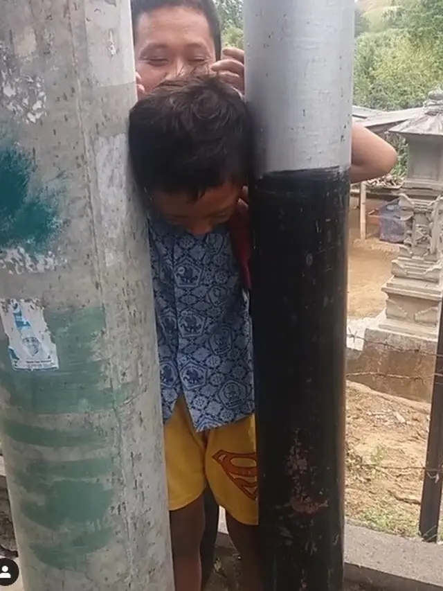 kepala bocah tersangkut di tiang listrik