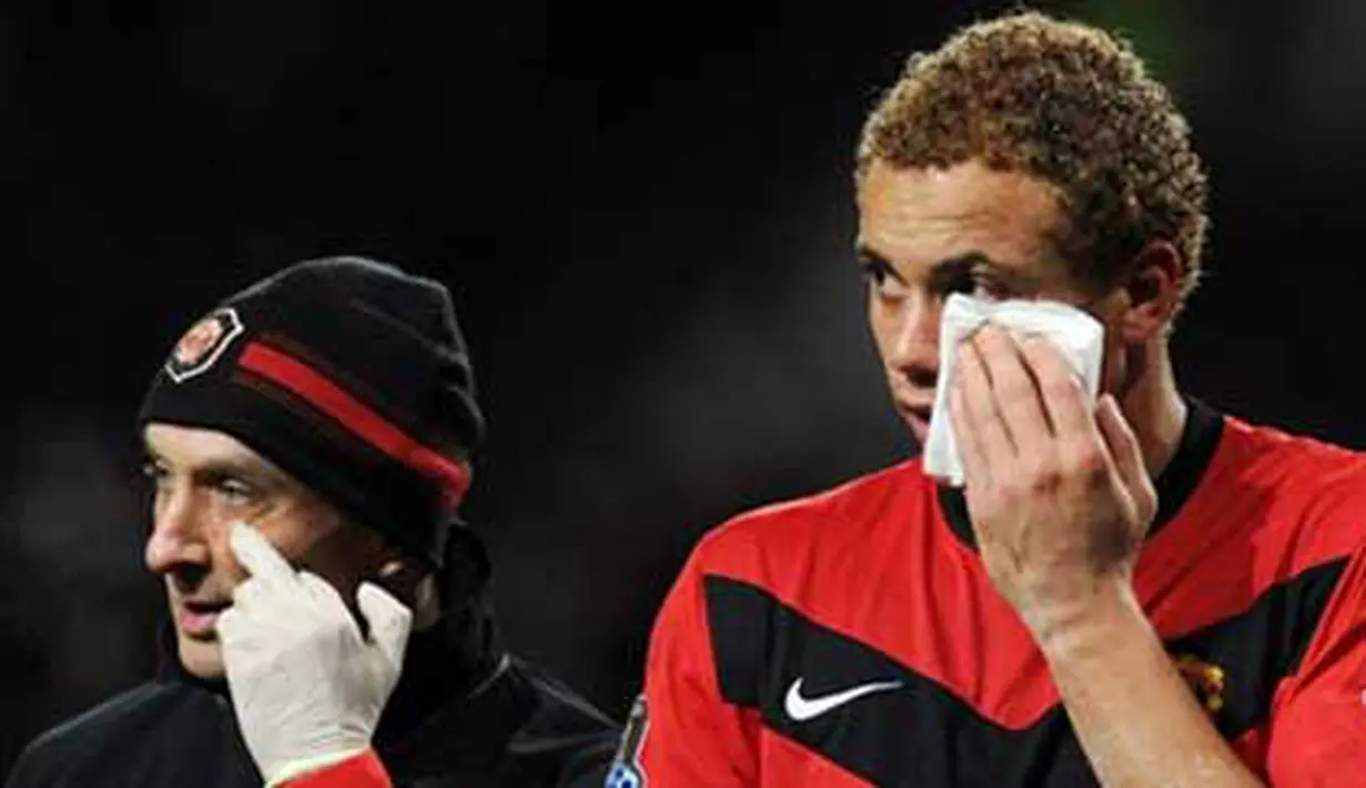 Bek Manchester United, Wes Brown (R) menerima perawatan menyusul cedera di pipinya di laga lawan Tottenham Hotspur yang berlangsung di Old Trafford, 1 Desember 2009. AFP PHOTO / PAUL ELLIS 