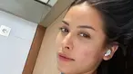 Inilah potret Estelle Linden yang terlihat pede memamerkan wajah dengan jerawat di pipi. Wanita 26 tahun ini tetap cantik meski tanpa polesan makeup. (Liputan6.com/IG/@estelleelinden).