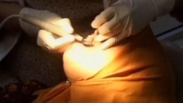 Tipu Daya Behel Murah l Klip 2