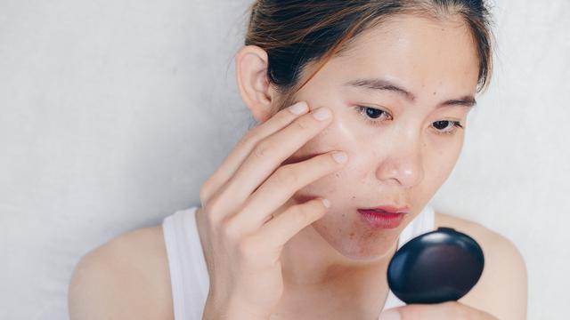 Kesalahan Saat Membersihkan Komedo