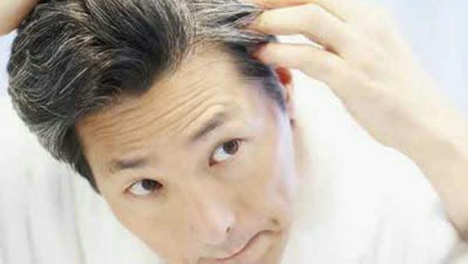 5 Penyebab Utama Datangnya Uban Di Usia Muda Fashion Beauty