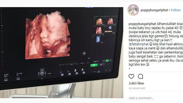 Poppy Bunga