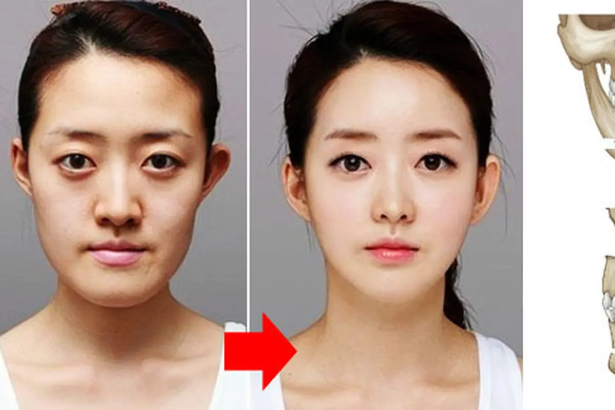Foto: copyright kpsurgery.co