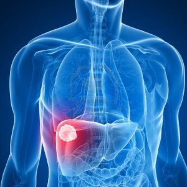 6 Gejala Ini Tunjukkan Hati Anda Rusak Dan Penuh Racun Citizen6 Liputan6 Com