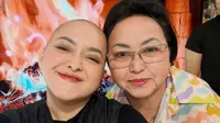 Cukur Habis Rambut, Lizzie Parra Dikelilingi Orang Tersayang di Tengah Perjuangan Lawan Kanker