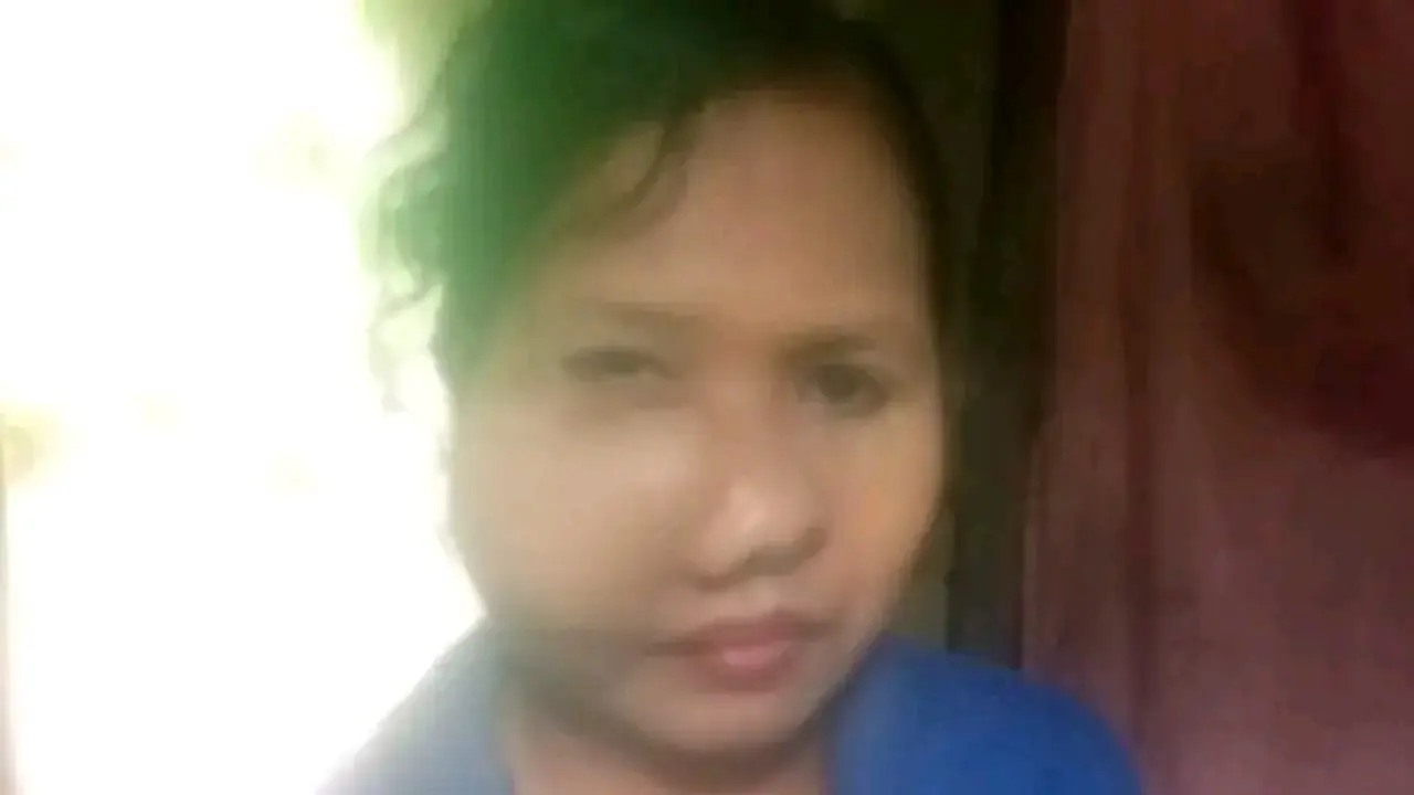 Wanita disabilitas di NTT mengalami pembengkakan aneh di pipi. (Liputan6.com/Ola Keda)