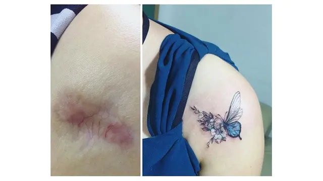 Wanita Ini Kreasikan Bekas Luka dengan Tato, 7 Hasilnya Mengagumkan