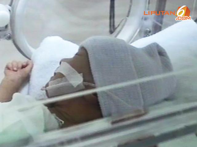 Kronologi Penolakan 10 Rs Hingga Ajal Menjemput Bayi Dera News Liputan6 Com