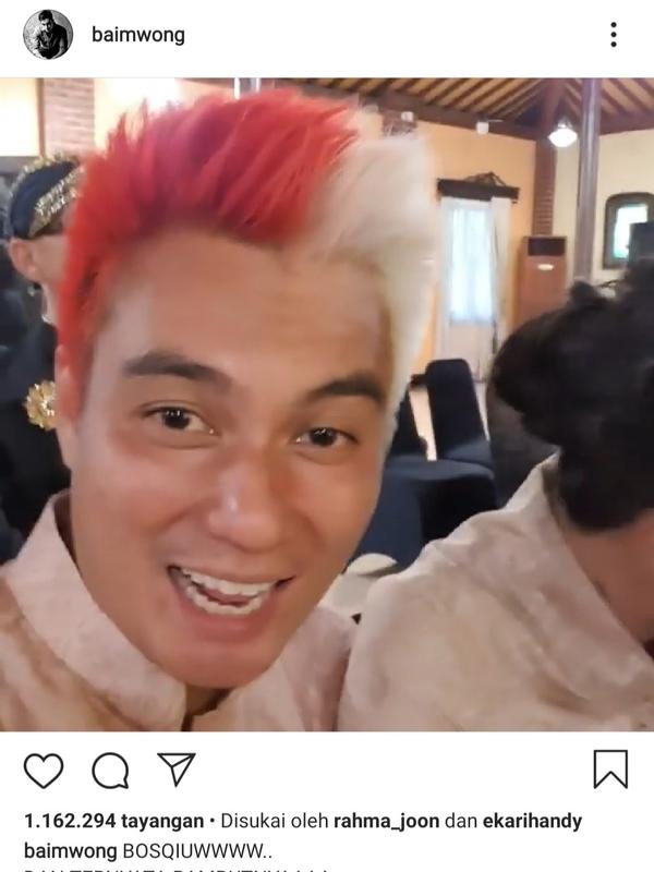 Warna rambut baru Baim Wong. (Instagram.com/baimwong)