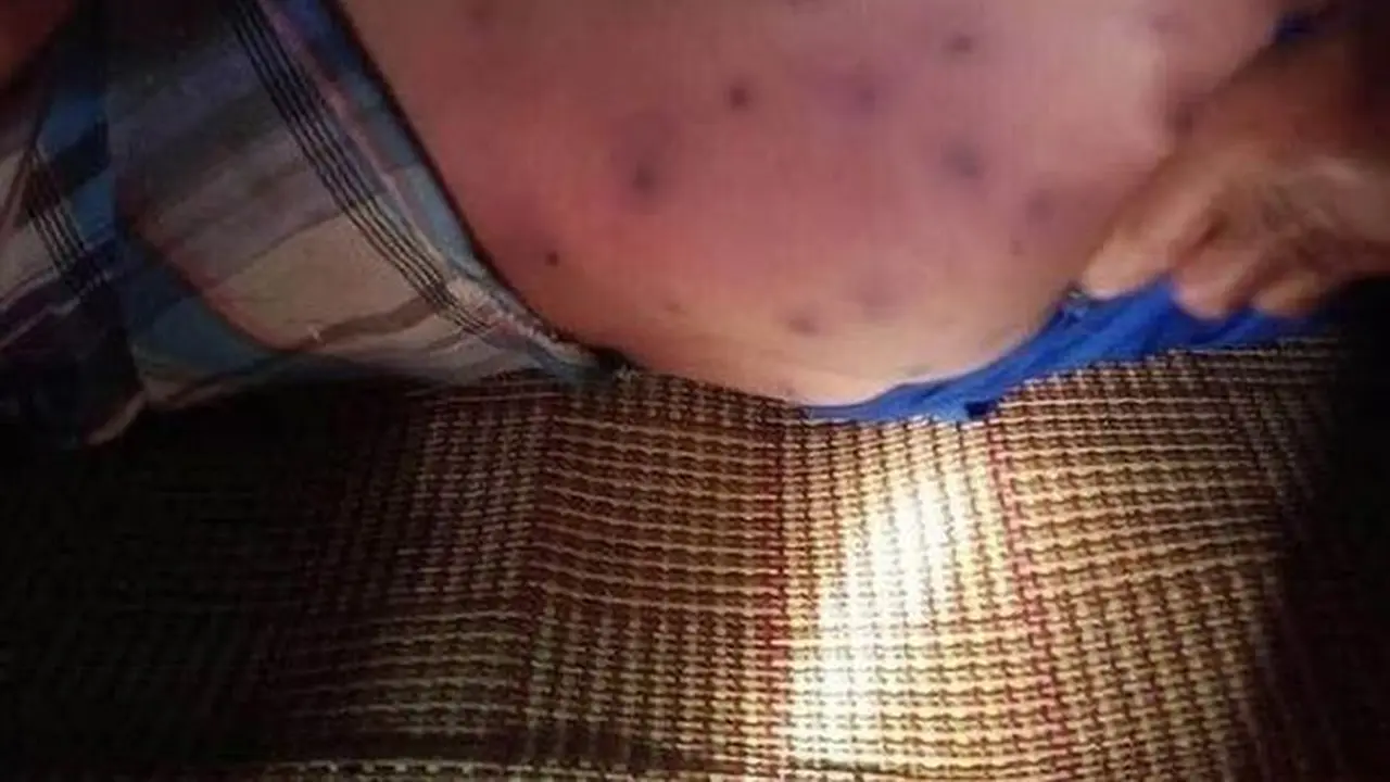Tak Sengaja Memukul Sarang, Bocah Ini Meninggal Dunia Setelah Diserang 30 Lebah