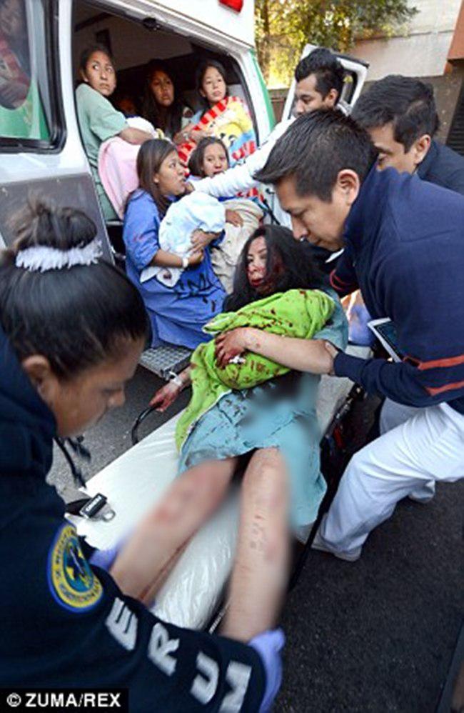 Para ibu yang terluka saat berusaha menyelamatkan bayinya | foto: copyright dailymail.co.uk