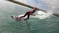 Atlet Surfing Lahirkan Seorang Anak 8 Minggu Lebih Awal
