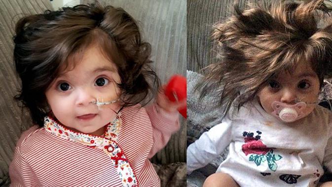 Kenalkan Bella Cole Bayi Punya Rambut Lebat Seperti Memakai Wig Parenting Fimela Com