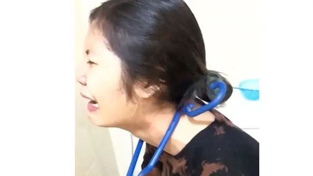 Hanger Tersangkut di Leher, YouTuber Ini Menangis Bingung Hingga Viral