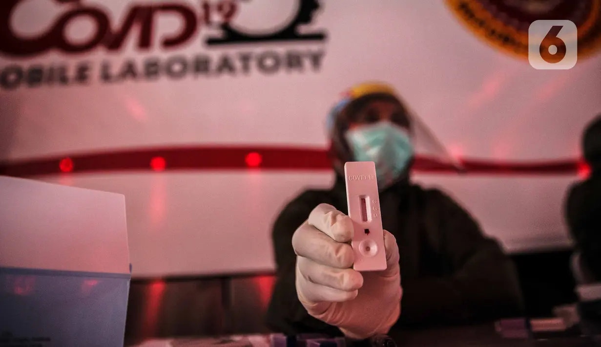 Petugas Kesehatan menunjukkan hasil tes diagnostik cepat Covid-19 di Terowongan Kendal, Jakarta, Rabu (6/5/2020). Pemeriksaan yang diselenggarakan BIN tersebut untuk mencegah penyebaran Covid-19 dari orang yang berpotensi terpapar saat beraktivitas di ruang publik. (Liputan6.com/Faizal Fanani)