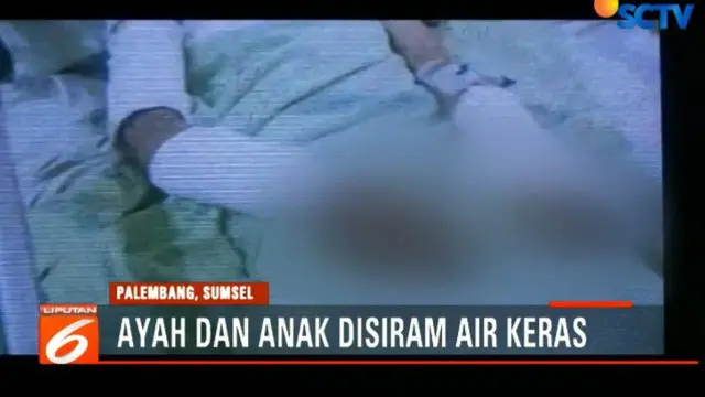 Kedua korban hingga kini masih menjalani perawatan di Rumah Sakit Muhammad Husein Palembang.