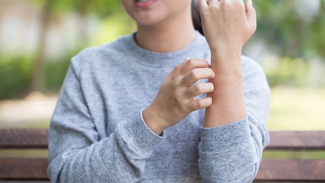 Kulit Gatal Saat Udara Dingin? Ini Penyebabnya (Chajamp/Shutterstock)