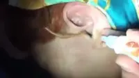 Seorang gadis remaja yang mengeluh telinganya sakit kaget saat mendapati lipan keluar dari telinganya