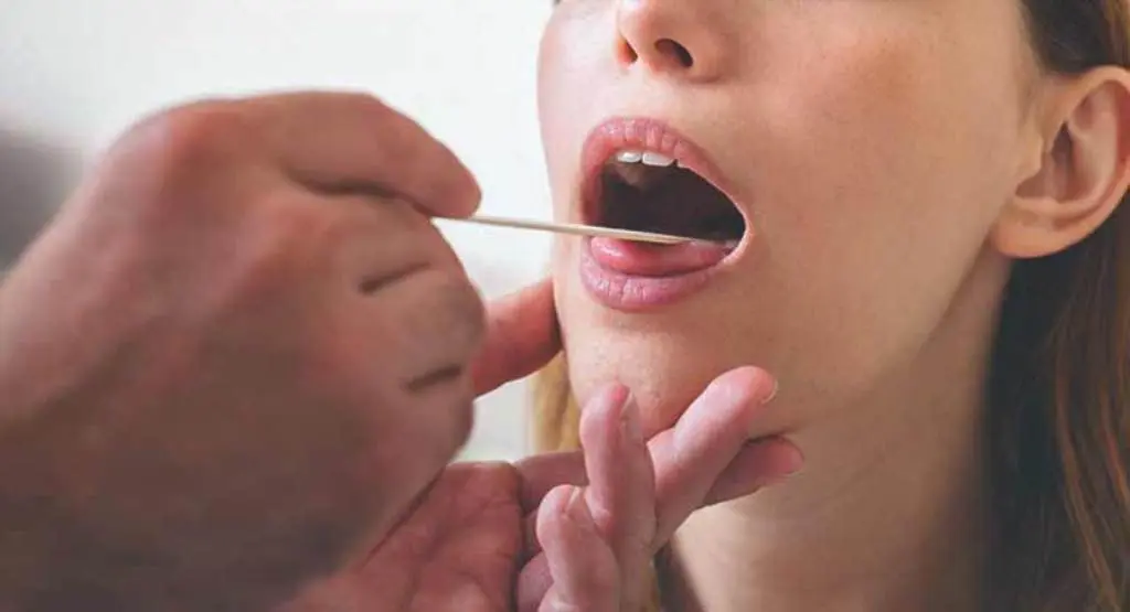 (Ilustrasi) Pemeriksaan lidah. | Sumber Foto: Healthline.com