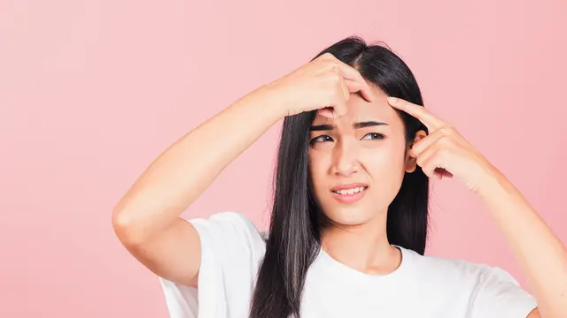 Mengetahui Penyebab Jerawat Berdasarkan Letaknya di Wajah, Kira-Kira Kenapa Ya?