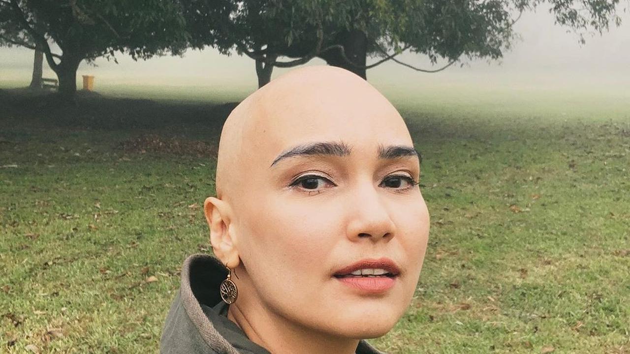 Ada Tumor Ganas Sebesar 16 Cm di Indung Telur Feby Febiola