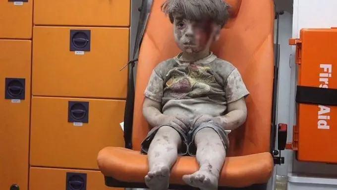 Alami Pendarahan Internal, Kakak Omran Tewas di Aleppo