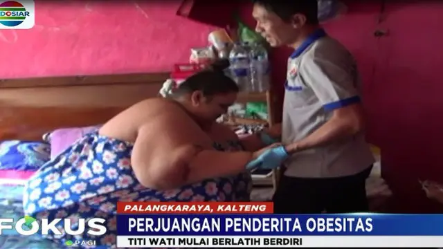 Titi Wati Penderita Obesitas di Palangkaraya Kini Sudah Bisa Berjalan