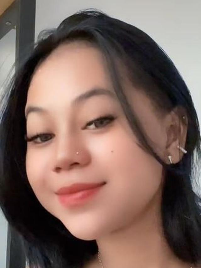 6 Potret Terbaru Cimoy Nuraini Usai Filler Hidung, Tampil Beda