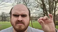Mainan Masa Kecil Nyangkut di Telinga. (Sumber: Mirror.co.uk)