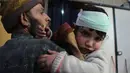 Ekspresi seorang anak yang terluka akibat serangan udara pasukan Assad di wilayah Ghouta timur, Suriah (7/2). Karena banyak memakan korban PBB pun meminta kepada sejumlah pihak untuk melakukan gencatan senjata demi kemanusiaan. (AFP Photo/Hamza Al-Ajweh)